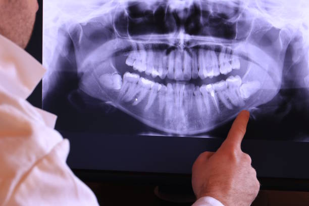 Best 24-Hour Emergency Dentist in Mcswain, CA
