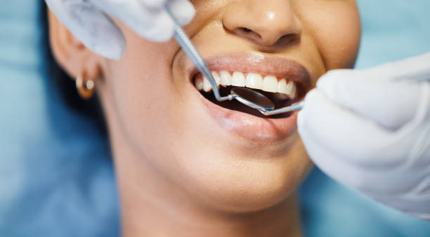 Best 24-Hour Emergency Dentist in Mcswain, CA