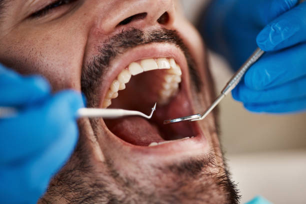Best Emergency Dentist for Special Needs Patients in Mcswain, CA
